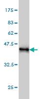 Anti-KIF15 Mouse Monoclonal Antibody [clone: 4D4]