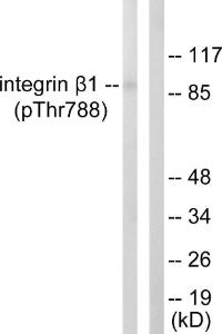 Western blot analysis of lysates from HeLa cells treated with UV 15' using Anti-Integrin beta1 (phospho Thr788) Antibody. The right hand lane represents a negative control, where the Antibody is blocked by the immunising peptide