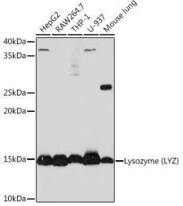 Western blot analysis of extracts of various cell lines, using Anti-Lysozyme Antibody [ARC0276] (A307449) at 1:1,000 dilution