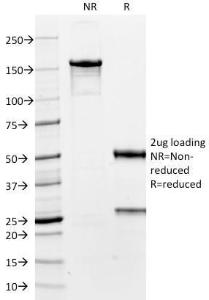 Anti-TTF1 Mouse Monoclonal Antibody [clone: 8G7G3/1]