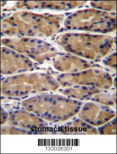 Anti-UPRT Rabbit Polyclonal Antibody