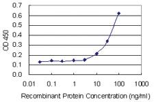 Anti-AKR1C8P Mouse Monoclonal Antibody [clone: 4G8]