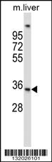 Anti-UPRT Rabbit Polyclonal Antibody