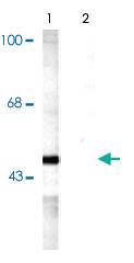 Anti-MAP2K5 Rabbit Polyclonal Antibody