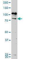 Anti-NEK5 Mouse Monoclonal Antibody [clone: 7G2]