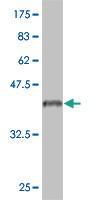 Anti-IL18RAP Mouse Monoclonal Antibody [clone: 4G4]