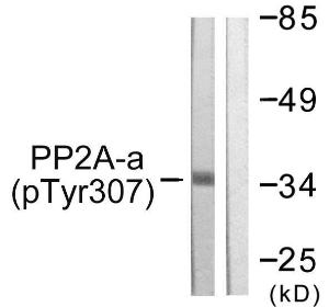 Western blot analysis of lysates from A549 cells using Anti-PP2A-alpha (phospho Tyr307) Antibody. The right hand lane represents a negative control, where the antibody is blocked by the immunising peptide