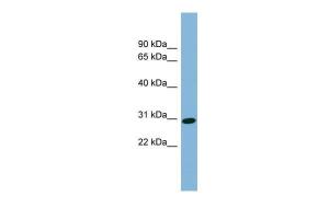 Anti-CENPQ Rabbit Polyclonal Antibody