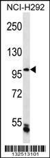 Anti-CHTF18 Rabbit Polyclonal Antibody (HRP (Horseradish Peroxidase))