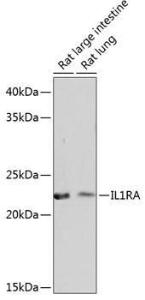 Anti-IL-1RA antibody