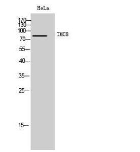 Anti-TMC8 antibody