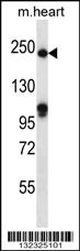 Anti-SLIT1 Rabbit Polyclonal Antibody