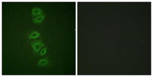 Immunofluorescence analysis of A549 cells using Anti-PP2A-alpha (phospho Tyr307) Antibody. The right hand panel represents a negative control, where the antibody was pre-incubated with the immunising peptide