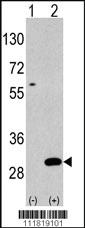 Anti-UBTD1 Rabbit Polyclonal Antibody