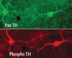 Anti-TH Rabbit Polyclonal Antibody