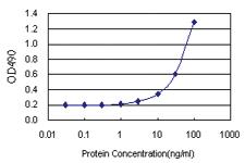 Anti-IFI35 Antibody Pair