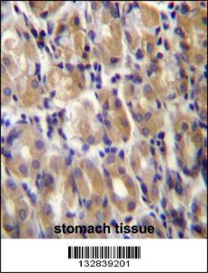 Anti-TOR1B Rabbit Polyclonal Antibody (HRP (Horseradish Peroxidase))