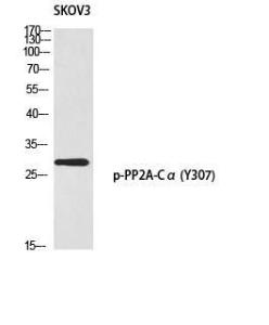 Western blot analysis of SKOV3 using Anti-PP2A-alpha (phospho Tyr307) Antibody