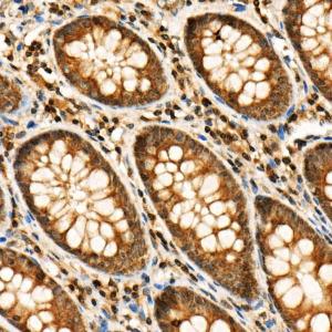 Immunohistochemistry analysis of paraffin-embedded human colon tissue using Anti-RIP3 (phospho Ser227) Antibody (A305777) at a dilution of 1:20 (40X lens). Perform high pressure antigen retrieval with 10 mM citrate buffer pH 6.0 before commencing with IHC staining protocol