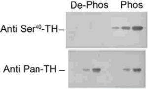 Anti-TH Rabbit Polyclonal Antibody