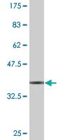 Anti-DDAH1 Mouse Monoclonal Antibody [clone: 3F7]