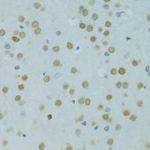 Immunohistochemistry analysis of paraffin-embedded rat brain using Anti-Mus81 Antibody (A10001) at a dilution of 1:100 (40x lens) Perform microwave antigen retrieval with 10 mM PBS buffer pH 72 before commencing with IHC staining protocol