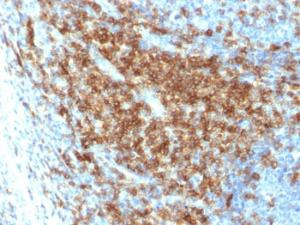 Anti-CD43 antibody