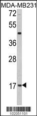 Anti-Leptin (LEP) Rabbit Polyclonal Antibody