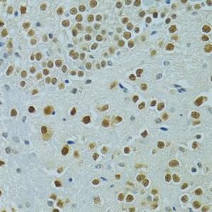 Immunohistochemistry analysis of paraffin-embedded mouse brain using Anti-Mus81 Antibody (A10001) at a dilution of 1:100 (40x lens) Perform microwave antigen retrieval with 10 mM PBS buffer pH 72 before commencing with IHC staining protocol