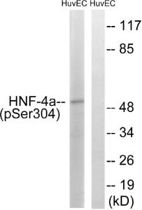 Western blot analysis of lysates from HUVEC cells treated with EGF 200 ng/ml 30' using Anti-HNF4 alpha (phospho Ser313) Antibody. The right hand lane represents a negative control, where the antibody is blocked by the immunising peptide