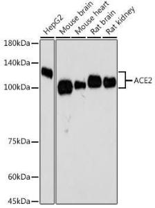 Anti-ACE2 Rabbit Monoclonal Antibody [clone: ARC50948]