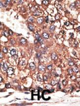 Anti-Leptin Receptor (LEPR) Rabbit Polyclonal Antibody