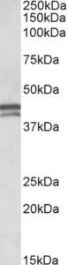 EB10917 (0.1 µg/ml) staining of Human Placenta lysate (35 µg protein in RIPA buffer). Primary incubation was 1 hour. Detected by chemiluminescence.