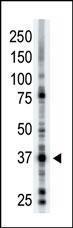 Anti-ART1 Rabbit Polyclonal Antibody (AP (Alkaline Phosphatase))