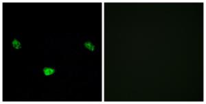 Immunofluorescence analysis of LOVO cells using Anti-HNF4 alpha (phospho Ser313) Antibody. The right hand panel represents a negative control, where the antibody was pre-incubated with the immunising peptide