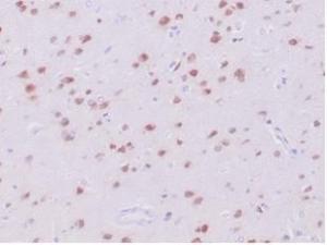 Immunohistochemical analysis of formalin-fixed, paraffin-embedded human cerebrum tissue using Anti-NeuN Antibody [NeuN/288R]