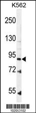 Anti-Leptin Receptor (LEPR) Rabbit Polyclonal Antibody