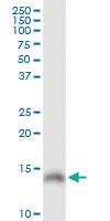 Anti-LGALS1 Rabbit Polyclonal Antibody