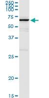 Anti-MPP2 Polyclonal Antibody Pair