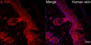 Anti-IL-1RA antibody