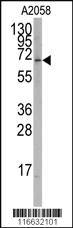 Anti-RORA Rabbit Polyclonal Antibody