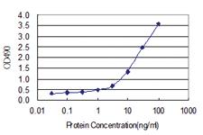 Anti-IFI35 Polyclonal Antibody Pair