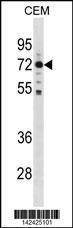 Anti-MAK Rabbit Polyclonal Antibody (FITC (Fluorescein Isothiocyanate))