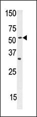 Anti-SLC29A1 Rabbit Polyclonal Antibody