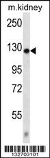 Anti-CACNA2D2 Rabbit Polyclonal Antibody