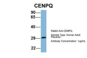 Anti-CENPQ Rabbit Polyclonal Antibody