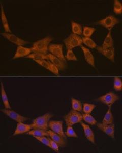 Immunofluorescence analysis of NIH-3T3 cells using Anti-Dcp1a Antibody [ARC1421] (A10006) at a dilution of 1:100 (40X lens). DAPI was used to stain the cell nuclei (blue)