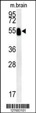 Anti-SLC29A1 Rabbit Polyclonal Antibody