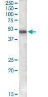 Anti-F2R Goat Polyclonal Antibody