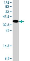 Anti-ERCC6 Mouse Polyclonal Antibody